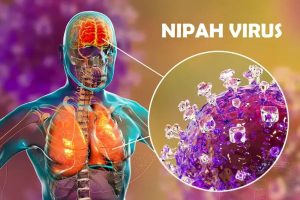 Khuyến cáo phòng chống dịch bệnh do virus Nipah